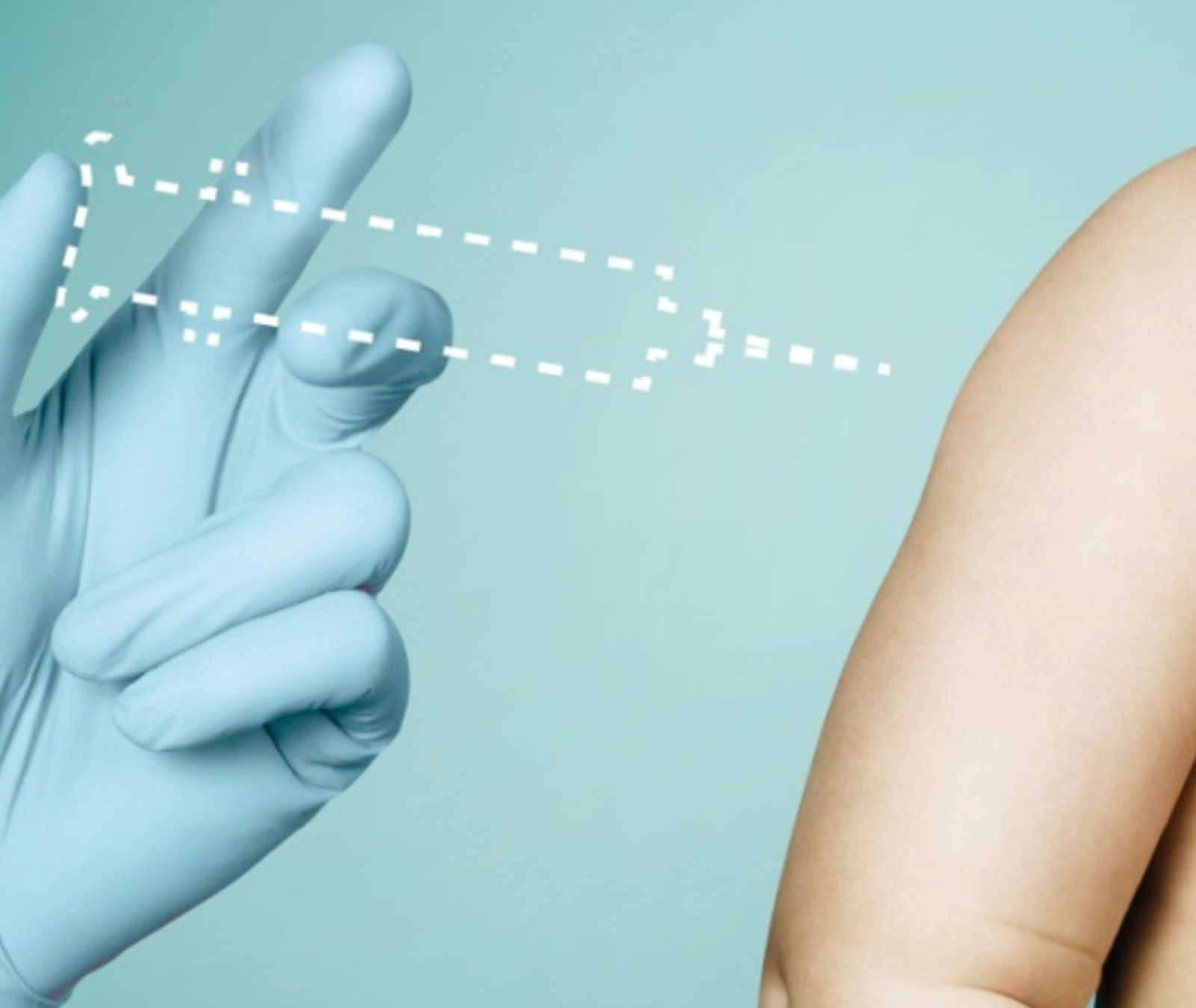 Emla Pflaster Fachanzeige