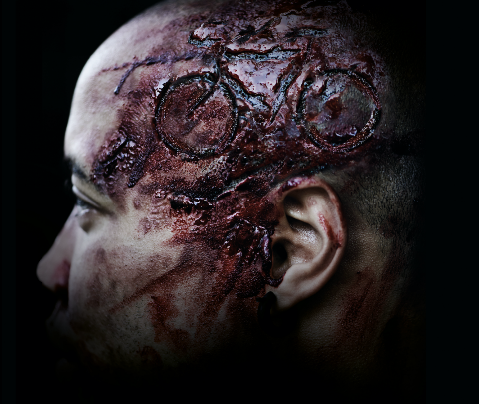 Patientenkommunikation - Fahrradhelme können Leben retten